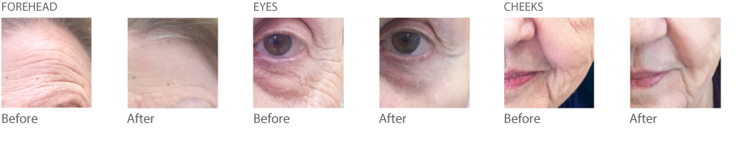 before-after2.jpg